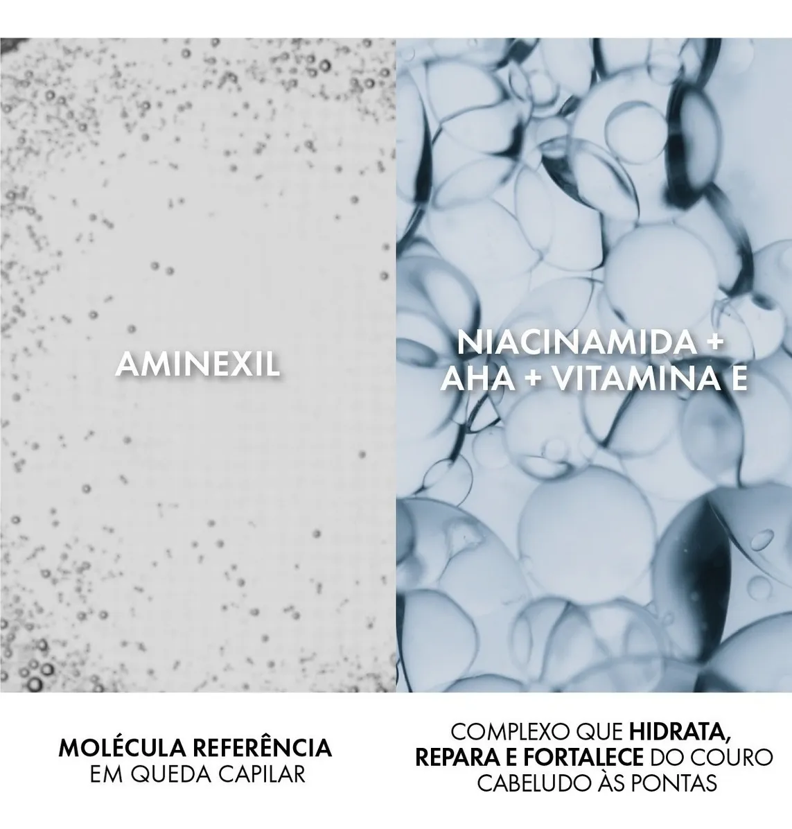 Imagem 6 de 7 de Shampoo Estimulante Antiqueda 400g Vichy Dercos