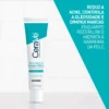 Imagem 6 de 11 de Gel Acne Control Cuidado Diário 40g CeraVe