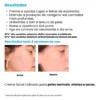 Imagem 6 de 6 de Creamy Skincare Ácido Glicólico 30g | Reduz Poros Dilatados, Melhora A Pele, Hidratação Profunda E Intensa, Controla O Brilho Excessivo | Todos Os Tipos De Pele, Noturno